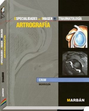 ARTROGRAFIA -ESPECIALIDADES- AMIRSYS