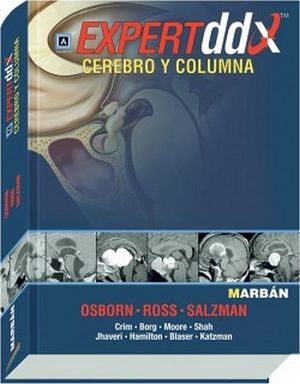 EXPERTDDX CEREBRO Y COLUMNA 