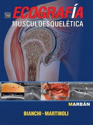 ECOGRAFA MUSCULOESQUELTICA