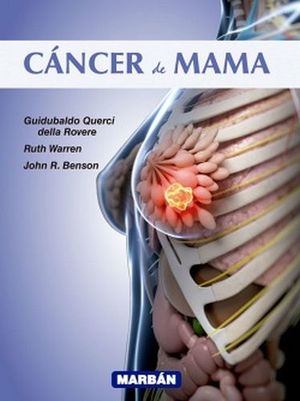 CANCER DE MAMA