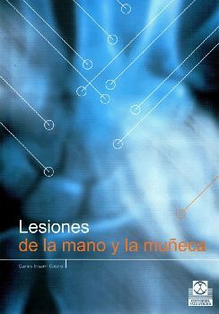 LESIONES DE LA MANO Y LA MU�ECA