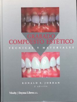 GRABADO; COMPUESTO ESTETICO, TECNICAS Y MATERIALES