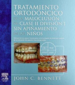 TRATAMIENTO ORTODONSICO DE LA MALOCLUSIONDE CLASE II