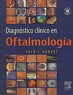 DIAGNOSTICO CLINICO EN OFTALMOLOGIA C/CD