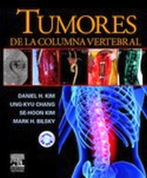 TUMORES DE LA COLUMNA VERTEBRAL