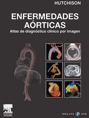 ENFERMEDADES AORTICAS. ATLAS DIAGN. IMAGEN