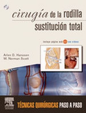 CIRUGA DE LA RODILLA (SUSTITUCIN TOTAL C/DVD)