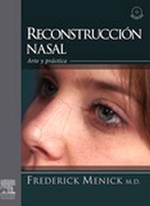 RECONSTRUCCION NASAL