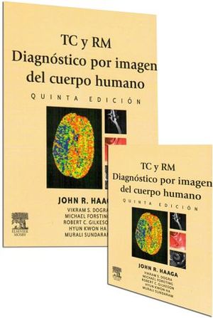 TC Y RM DIAGNSTICO POR IMAGEN DEL CUERPO HUMANO 5ED. 2VOL.