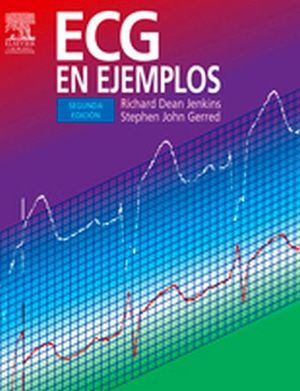 ECG EN EJEMPLOS 2ED