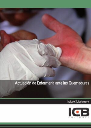 ACTUACIN DE ENFERMERA ANTE LAS QUEMADURAS
