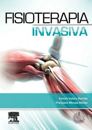 FISIOTERAPIA INVASIVA