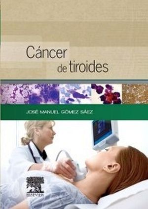 CANCER DE TIROIDES