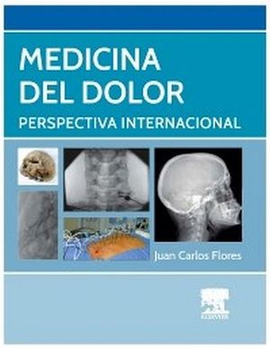 MEDICINA DEL DOLOR: PERSPECTIVA INTERNACIONAL