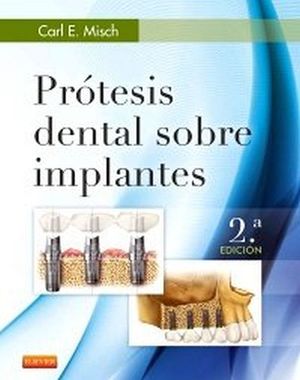 PROTESIS DENTAL SOBRE IMPLANTES 2ED.