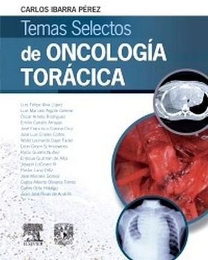 TEMAS SELECTOS DE ONCOLOGIA TORACICA