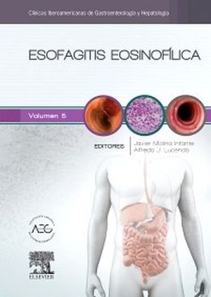 ESOFAGITIS EOSINOFILICA