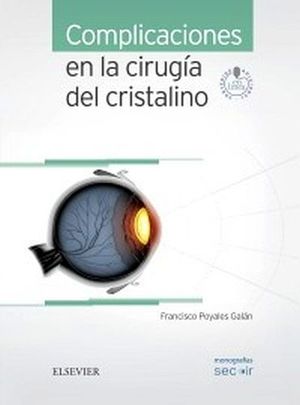 COMPLICACIONES EN LA CIRUGIA DEL CRISTALINO (C/ACCESO WEB)