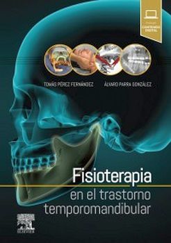 FISIOTERAPIA EN EL TRASTORNO TEMPOROMANDIBULAR