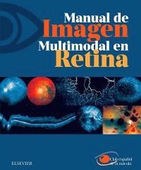 MANUAL DE IMAGEN MULTIMODAL EN RETINA CLUB ESPA�OL DE LA MACULA