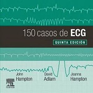 150 CASOS DE ECG 5ED.