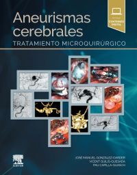ANEURISMAS CEREBRALES -TRATAMIENTO MICROQUIRRGICO-
