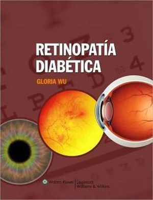 RETINOPATIA DIABETICA