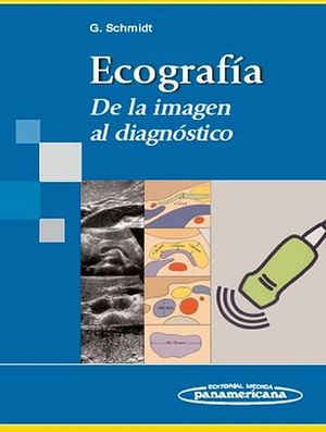 ECOGRAFA DE LA IMAGEN AL DIAGNSTICO