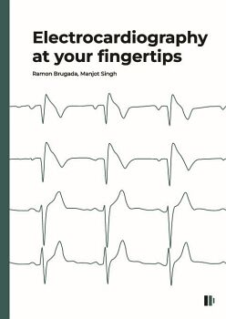 ELECTROCARDIOGRAPHY AT YOUR FINGERTIPS