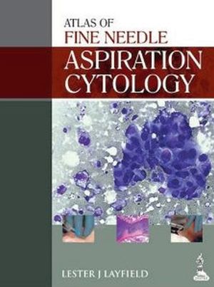 ATLAS OF FINE NEEDLE ASPIRATION CYTOLOGY