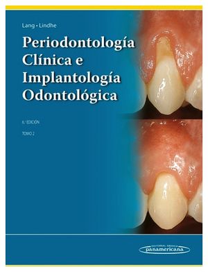 PERIODONTOLOG�A CL�NICA E IMPLANTOLOG�A ODONTOL�GICA 6ED. TOMO II