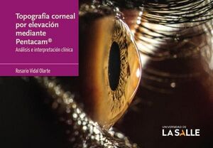 TOPOGRAFA CORNEAL POR ELEVACIN MEDIANTE PENTACAM