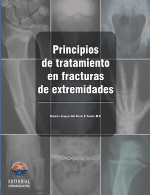 PRINCIPIOS DE TRATAMIENTO EN FRACTURAS DE EXTREMIDADES