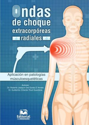 ONDAS DE CHOQUE EXTRACORPREAS RADIALES