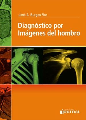 DIAGNOSTICO POR IMAGENES DEL HOMBRO