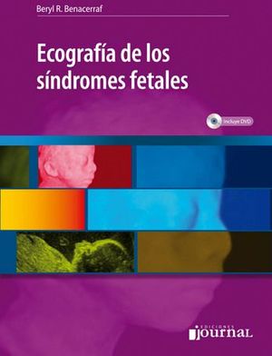 ECOGRAFIA DE LOS SINDROMES FETALES