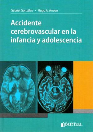 ACCIDENTE CEREBROVASCULAR EN LA INFANCIA Y ADOLESCENCIA