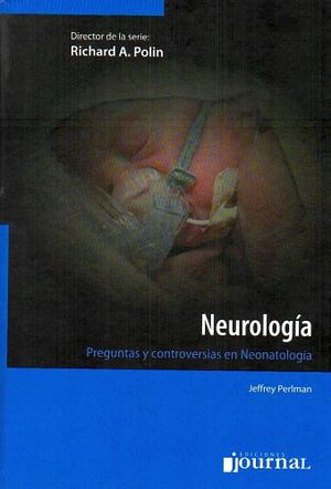 NEUROLOGA