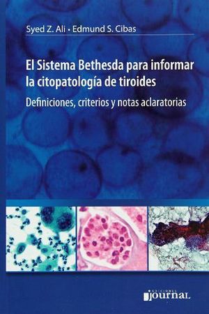 SISTEMA BETHESDA PARA INFORMAR LA CITOPATOLOGA DE TIROIDES