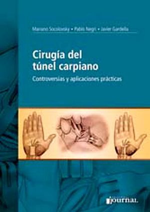 CIRUGIA DEL TUNEL CARPIANO
