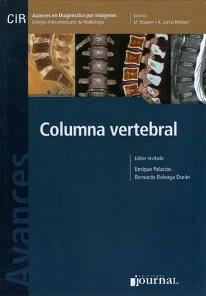 COLUMNA VERTEBRAL AVANCES EN DIAGNOSTICO POR IMAGENES X