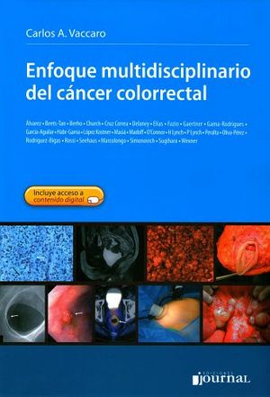 ENFOQUE MULTIDISCIPLINARIO DEL CANCER COLORRECTAL