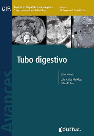 TUBO DIGESTIVO VOL.I (S-AVANCES EN DIAGNOSTICO POR IMAGEN)