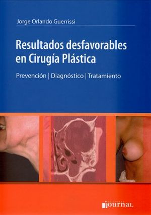 RESULTADOS DESFAVORABLES EN CIRUGIA PLASTICA