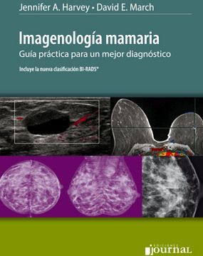 IMAGENOLOGA MAMARIA (GUA PRCTICA P/UN MEJOR DIAGNSTICO)