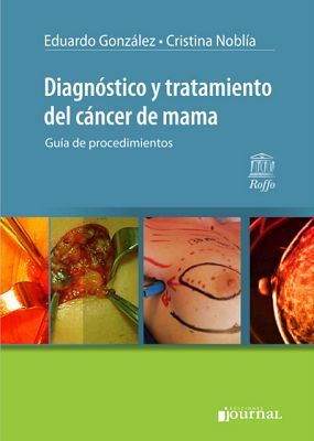 DIAGNOSTICO Y TRATAMIENTO DEL CANCER DE MAMA (GUIA DE PROCED.)