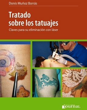 TRATADO SOBRE LOS TATUAJES -CLAVES P/SU ELIMINACION C/LASER '2017