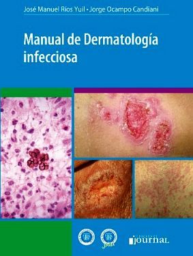 MANUAL DE DERMATOLOGA INFECCIOSA