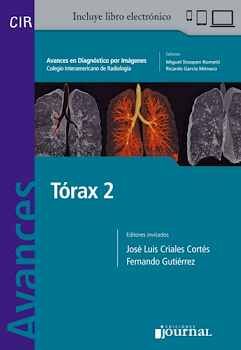 AVANCES EN DIAGNOSTICO POR IMAGENES: TORAX 2