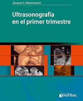 ULTRASONOGRAFIA EN EL PRIMER TRIMESTRE